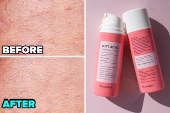 Before-and-after image showing skin improvement, with reduced blemishes and smoother texture after using a skincare product